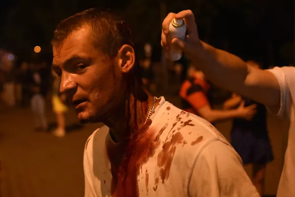 Участник протеста, раненный во время беспорядков в Минске после президентских выборов Участник протеста, раненный во время беспорядков в Минске после президентских выборов - Sputnik Латвия