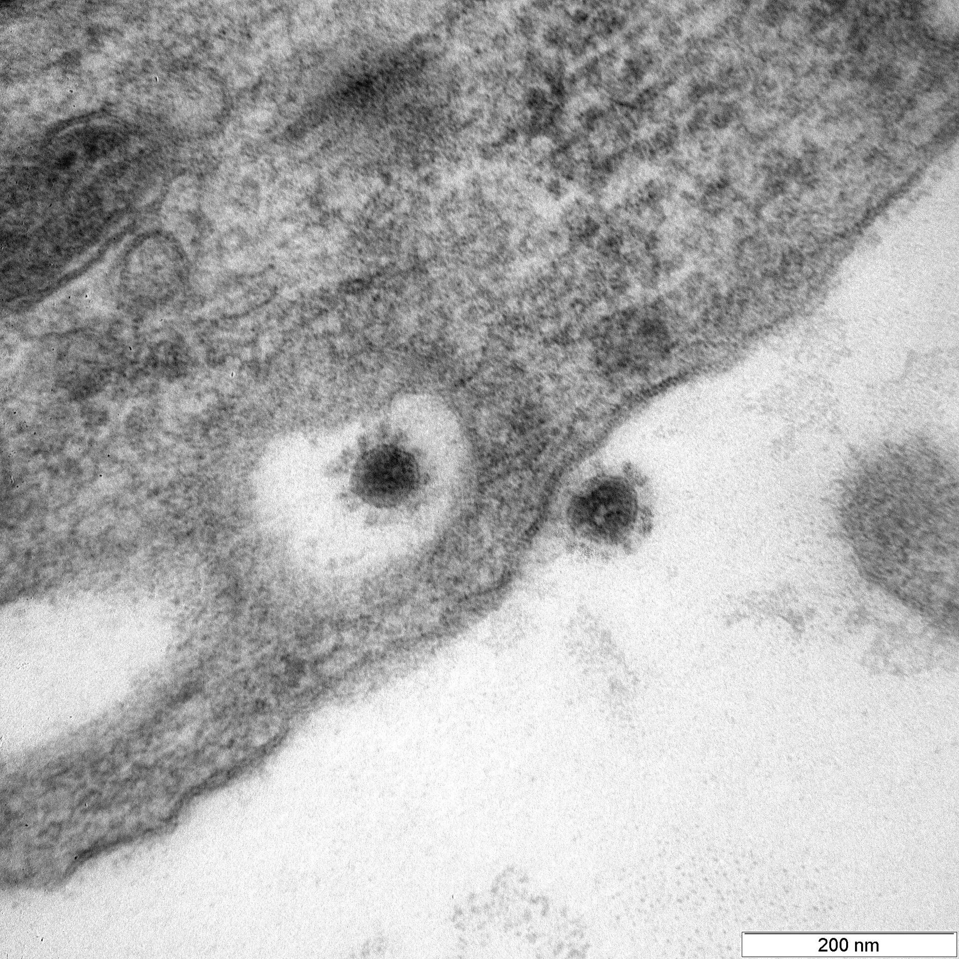 Фото дельта-штамма (индийского варианта) коронавируса, опубликованное научным центром Вектор - Sputnik Латвия, 1920, 25.10.2021