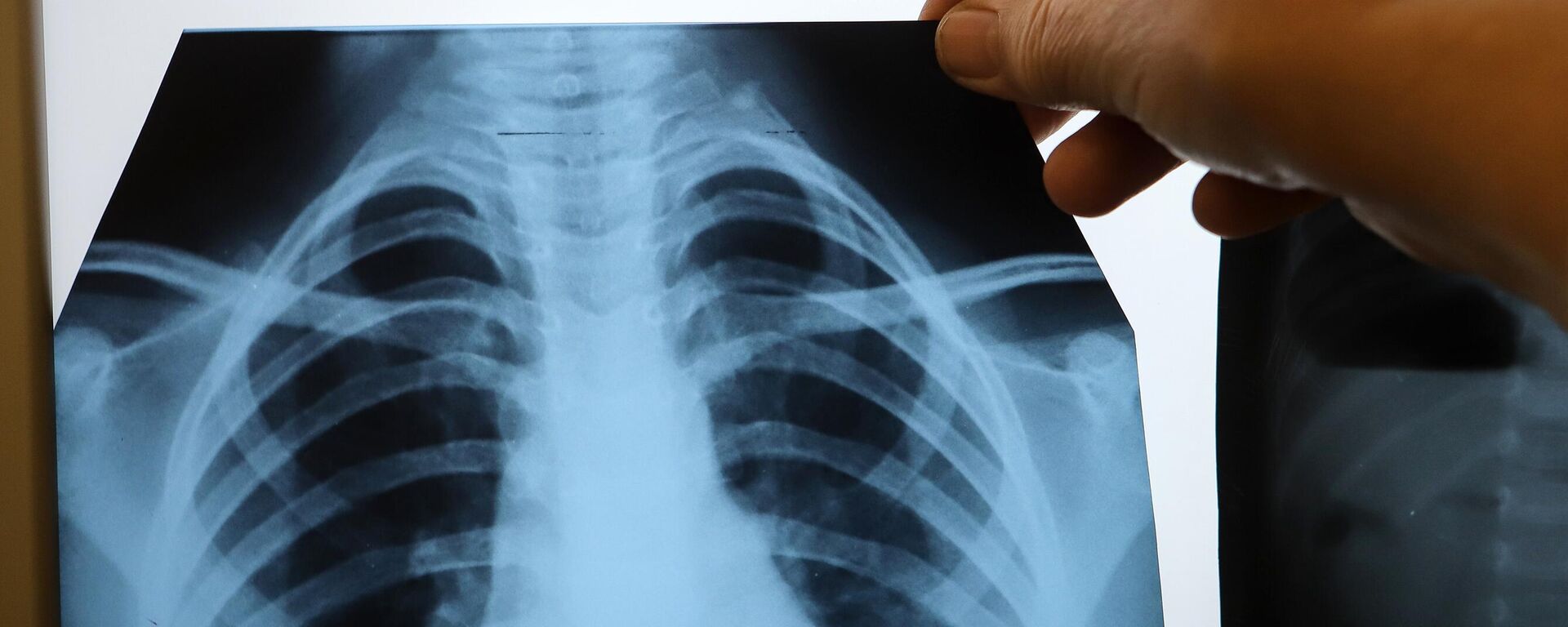 Рентген легких  - Sputnik Латвия, 1920, 04.11.2025