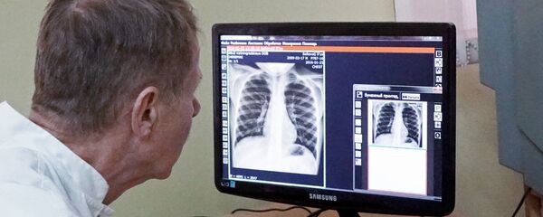 Врач знакомится с результатами рентгенологического исследования Врач знакомится с результатами рентгенологического исследования - Sputnik Латвия