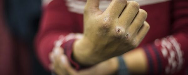 Vīrietis demonstrē sasistu dūri Vīrietis demonstrē sasistu dūri - Sputnik Latvija