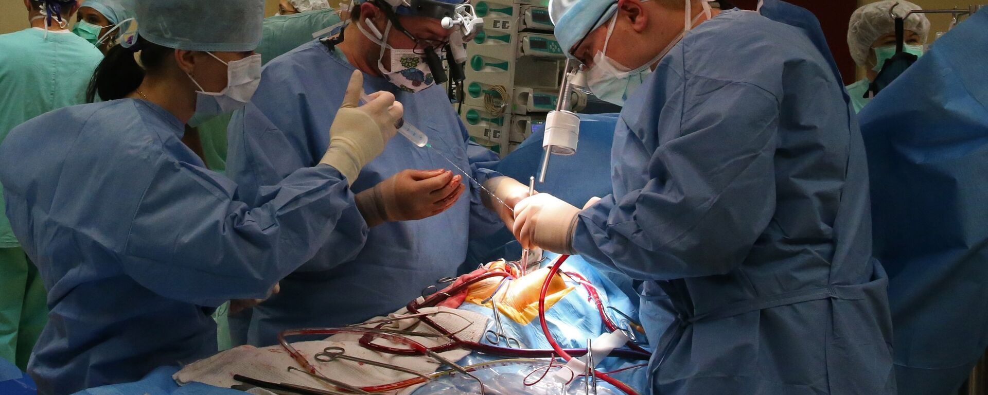 Хирурги проводят операцию на открытом сердце - Sputnik Латвия, 1920, 04.11.2021